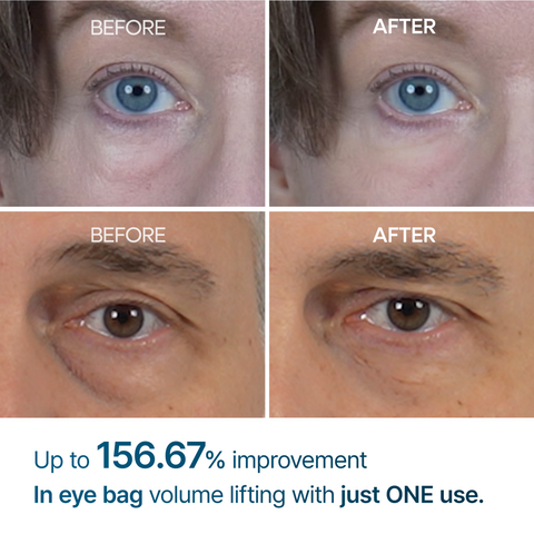 Dr. Melaxin Eyephalt Eye Bag Cream - Dark Circles Treatment Pakistan